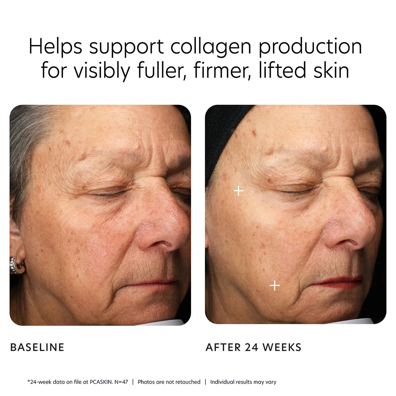MGF age renewal cream
