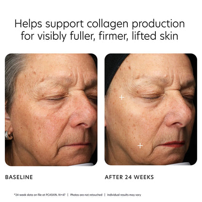 MGF age renewal cream
