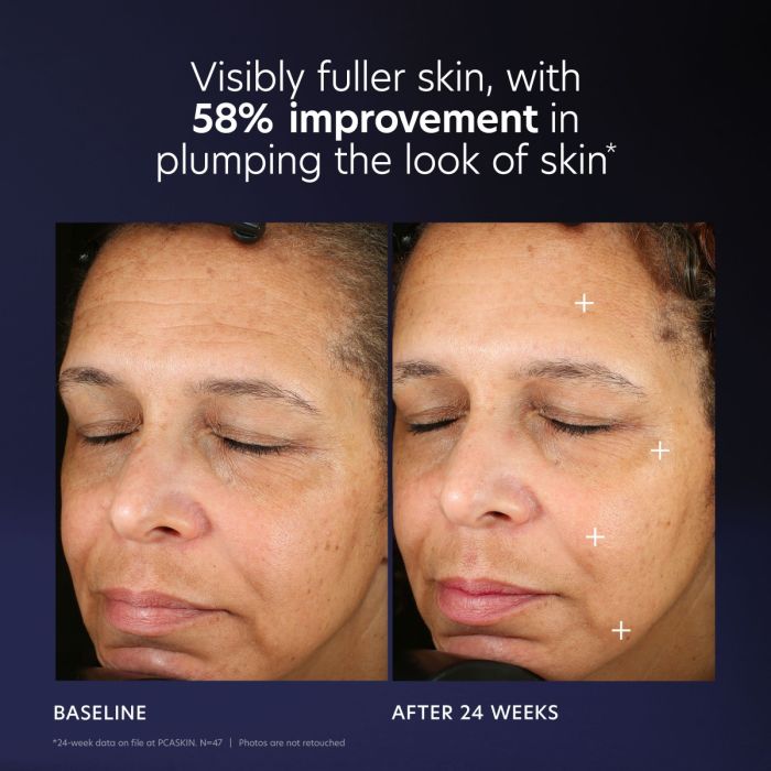 Pro Max PCA Skincare