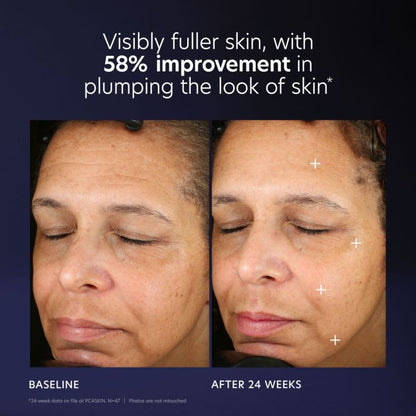 Pro Max PCA Skincare